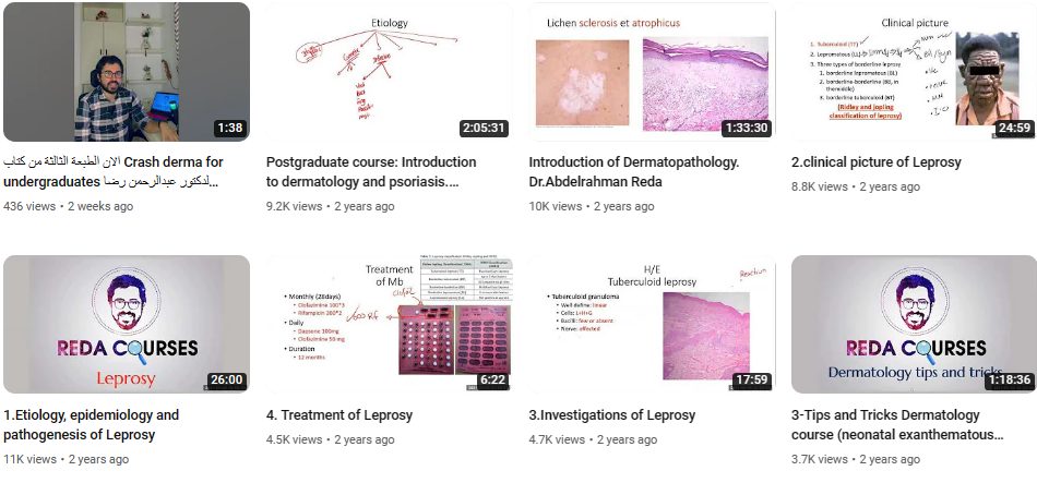 قناة D.Abdelrahman Reda Dermatology لتعليم طب الجلدية